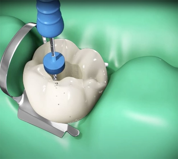 Allgemeines Bild von Zahnpasta