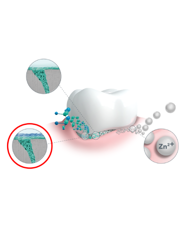 elmex Zahndiagramm