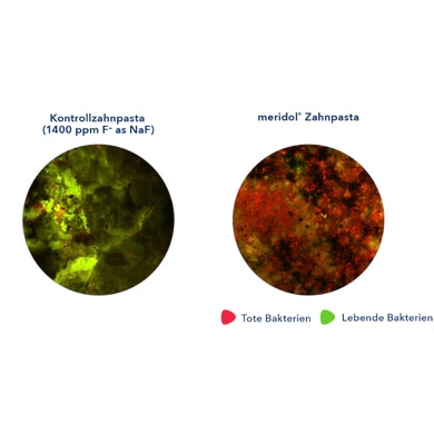 Zwei mikroskopische Bilder nebeneinander: Kontrolle (1450 ppm F– als NaF) mit mehr Grün (lebende Bakterien), meridol mit mehr Rot (tote Bakterien). Legende: Rot = tot, Grün = lebend.