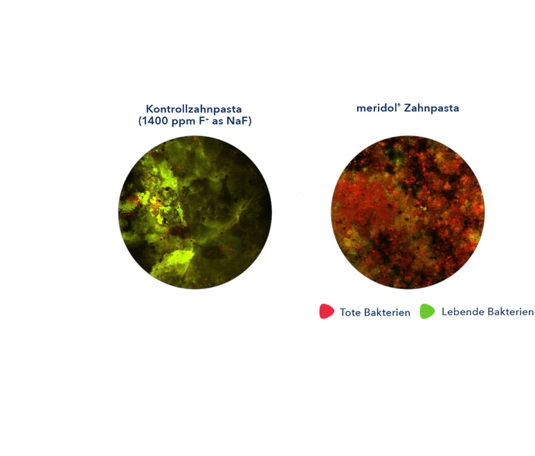 Zwei mikroskopische Bilder nebeneinander: Kontrolle (1450 ppm F– als NaF) mit mehr Grün (lebende Bakterien), meridol mit mehr Rot (tote Bakterien). Legende: Rot = tot, Grün = lebend.