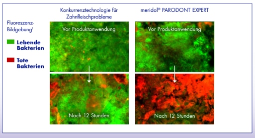 Fluoreszenzvergleich: Plaque vor Anwendung und nach 12 Std.; meridol PARODONT EXPERT tötet mehr B