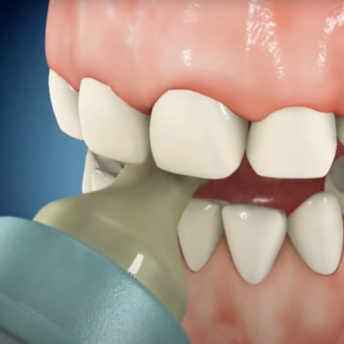 Wortwolke in Form einer Zahnpastatube mit Schwerpunkt auf „Kaliumnitrat“, mit Begriffen wie „Anti‑Gingivitis“, „Anti‑Karies“ und „Zahnpasta