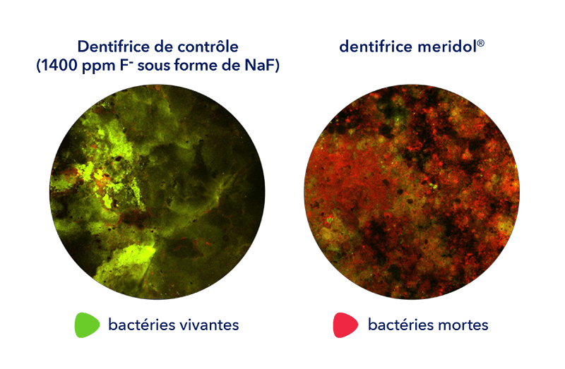 Deux images microscopiques côte à côte : témoin (1 450 ppm de fluorure – sous forme de NaF) avec plus de vert (bactéries vivantes), meridol avec plus de rouge (bactéries mortes). Légende : rouge = mort, vert = vivant.