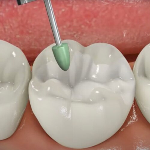Nuage de mots en forme de tube de dentifrice mettant l'accent sur « nitrate de potassium », avec des termes tels que « anti-gingivite », « anti-caries » et « dentifrice »