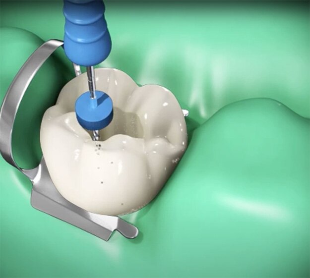 Image générale du dentifrice
