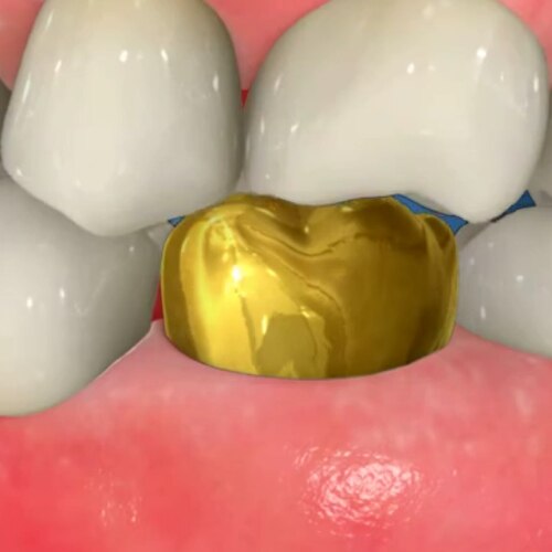 Nuage de mots en forme de tube de dentifrice, avec des termes tels que « nitrate de potassium », « anti-gingivite » et « protection contre les caries ».