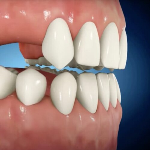 Nuage de mots en forme de tube de dentifrice, avec des termes tels que « nitrate de potassium », « anti-gingivite » et « protection contre les caries ».