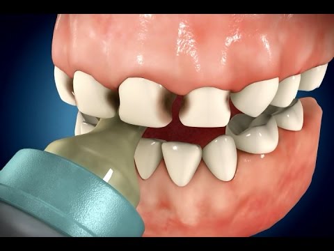 Vidéo sur l’odontologie pédiatrique
