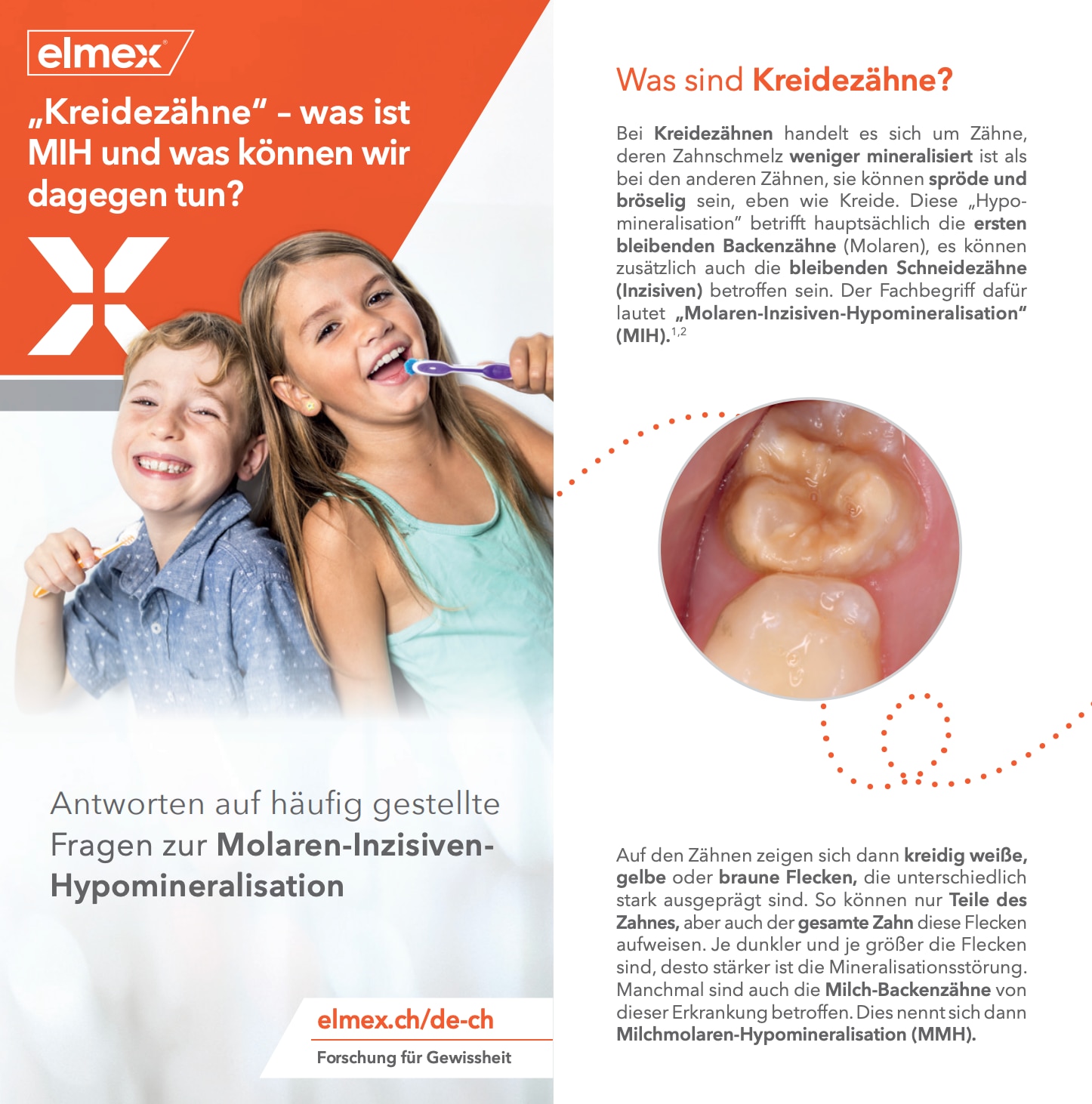 Fichier PDF sur le MIH : « Dents de craie »