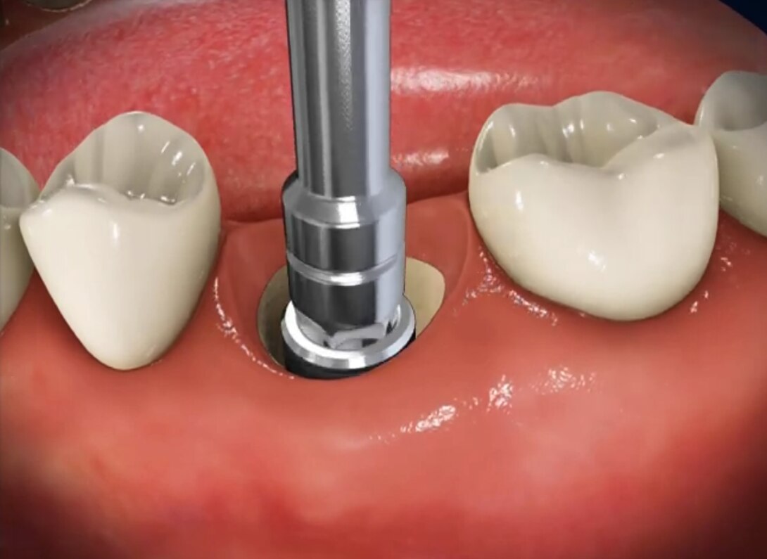 Wortwolke in Form einer Zahnpastatube mit Begriffen wie Kaliumnitrat, Anti-Gingivitis und Karies-Schutz.