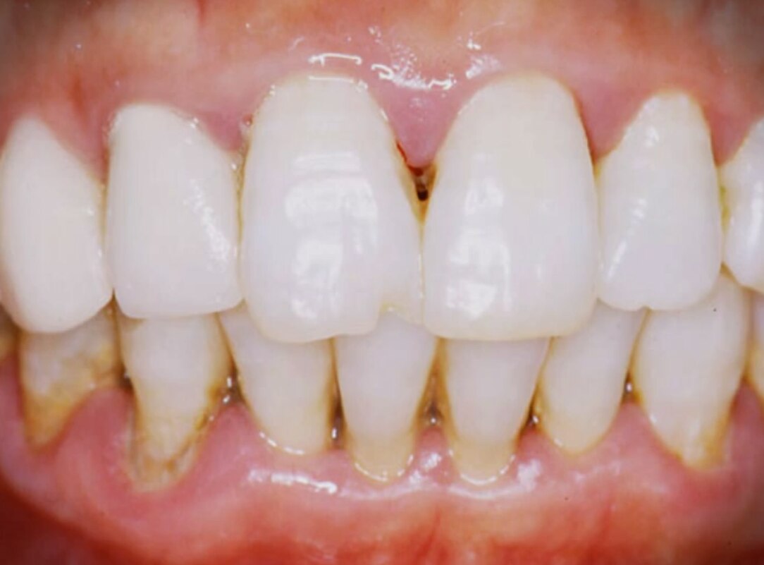 Nuage de mots en forme de tube de dentifrice, avec des termes tels que « nitrate de potassium », « anti-gingivite » et « protection contre les caries ».