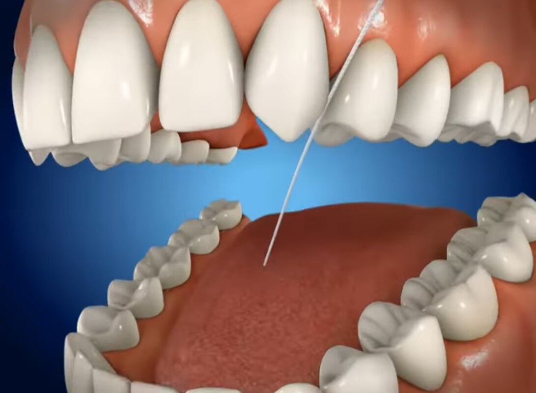Nuage de mots en forme de tube de dentifrice mettant l'accent sur « nitrate de potassium », avec des termes tels que « anti-gingivite », « anti-caries » et « dentifrice »