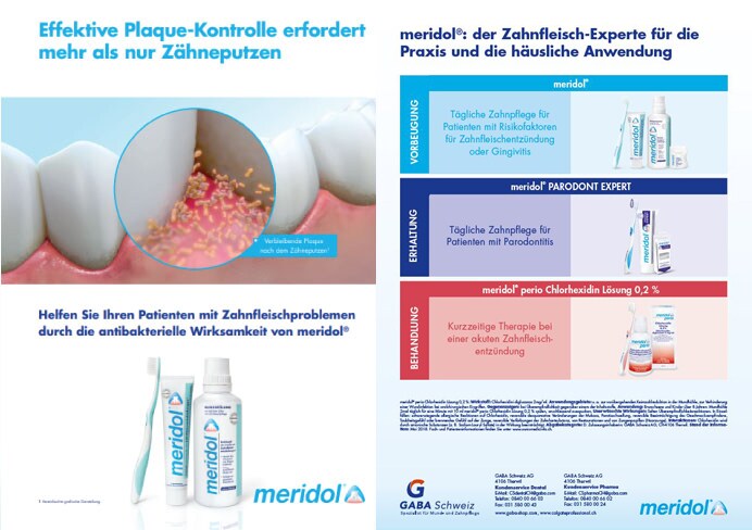 zur effektiven Plaque-Kontrolle für Ihre Patient*innen mit Zahnfleischproblemen
