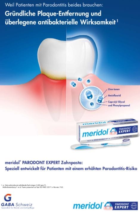 zur optimalen Behandlung von Parodontitis-Patient*innen