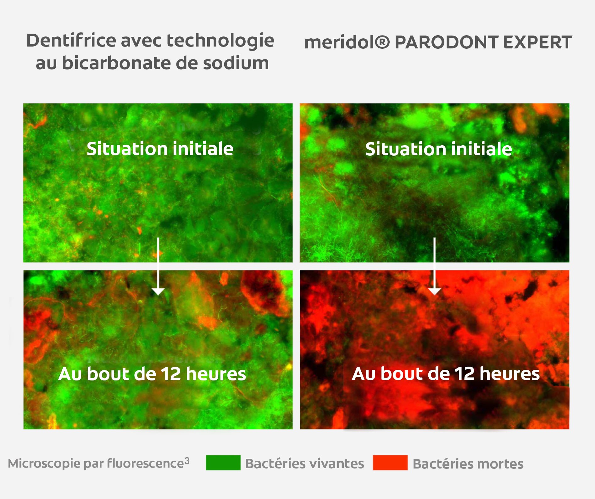 La microscopie par fluorescence montre l’effet antibactérien 12 heures après utilisation de meridol® PARODONT EXPERT 