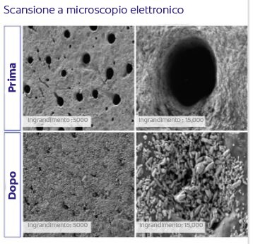 Microscopia elettronica a scansione (SEM)4