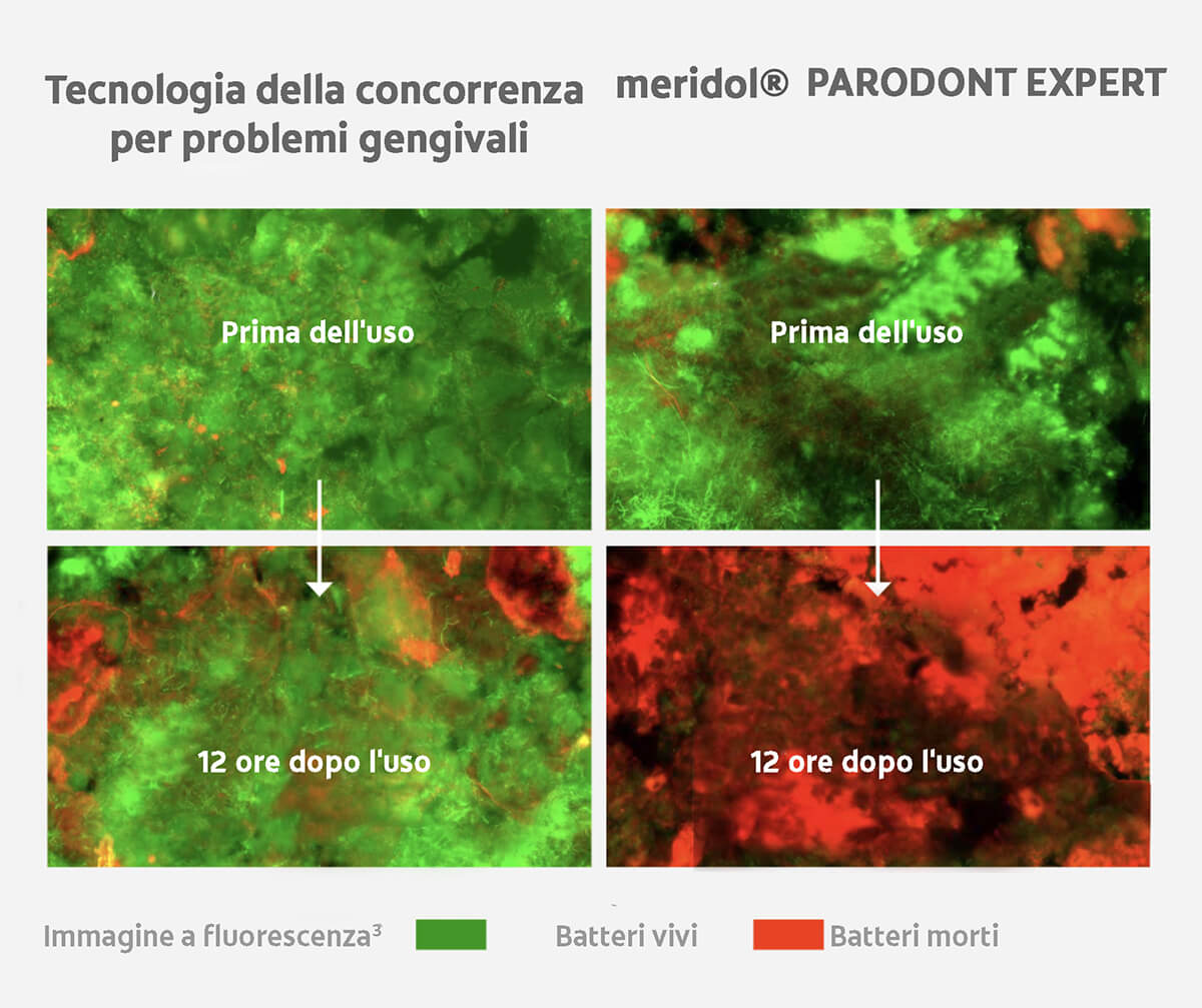 Puoi vedere un maggiore effetto antibatterico³